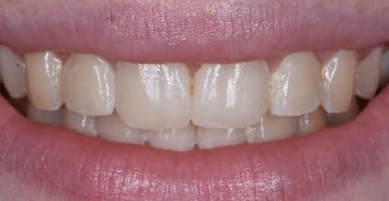 After Image