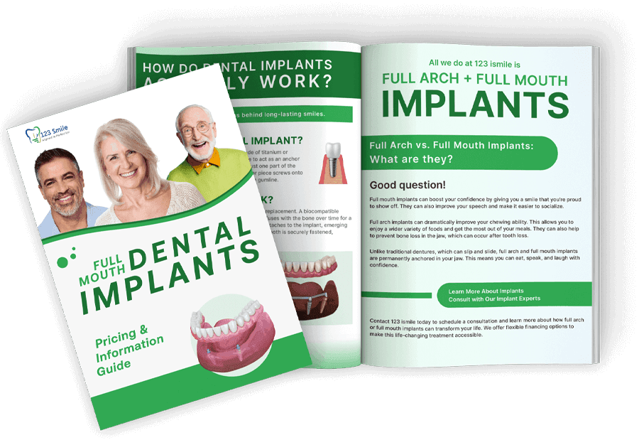 Dental Implant Guide